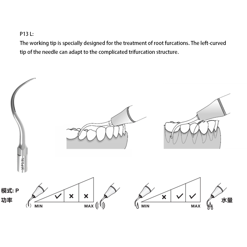 Dental Scaler Tips Ultrasonic Scaler Working Tips P13L for Root Furcations Treatment